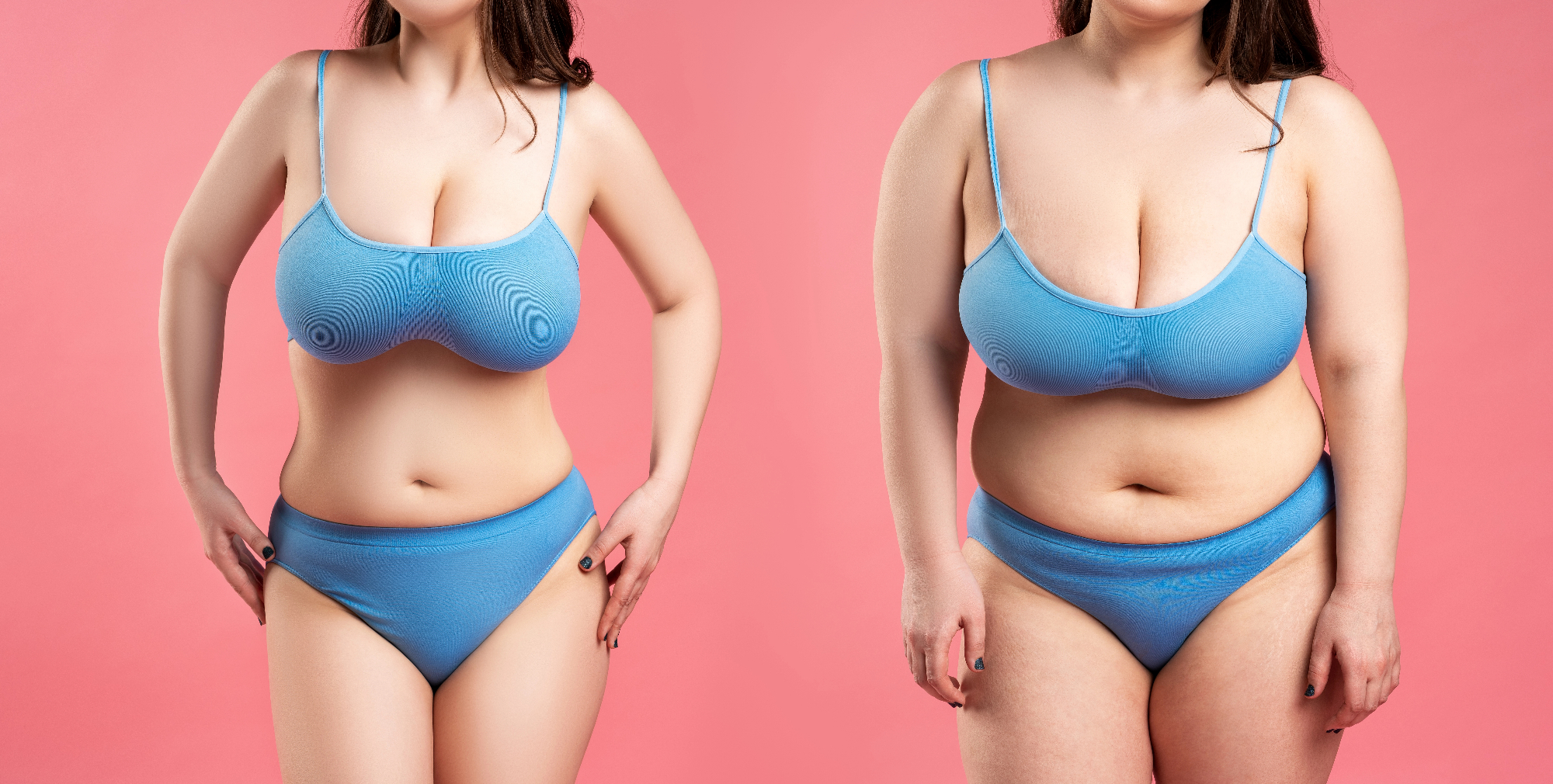 Migliorare l'aspetto fisico e la qualità della vita con mastoplastica